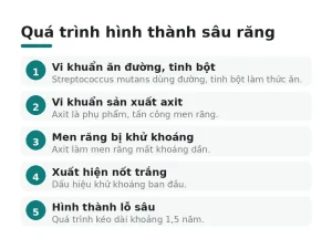 Quá trình hình thành sâu răng