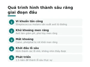 Quá trình hình thành sâu răng giai đoạn đầu