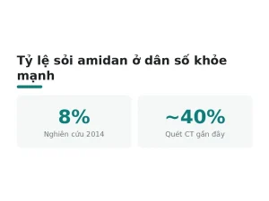 Tỷ lệ sỏi amidan ở dân số khỏe mạnh