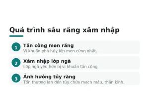 Quá trình sâu răng xâm nhập