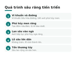 Quá trình sâu răng tiến triển