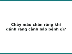 Chảy máu chân răng khi đánh răng cảnh báo bệnh gì?